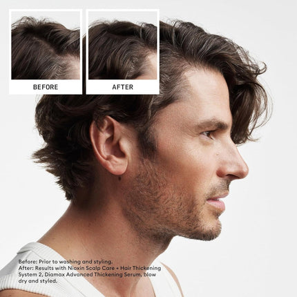 Nioxin System 2 Leave In Treatment - Natural Hair With Progressed Thinning