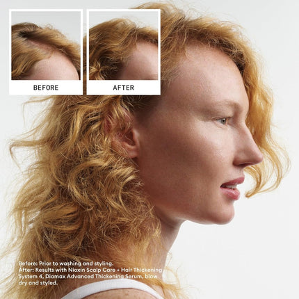 Nioxin System Kit 4 - Color Treated With Progressed Thinning