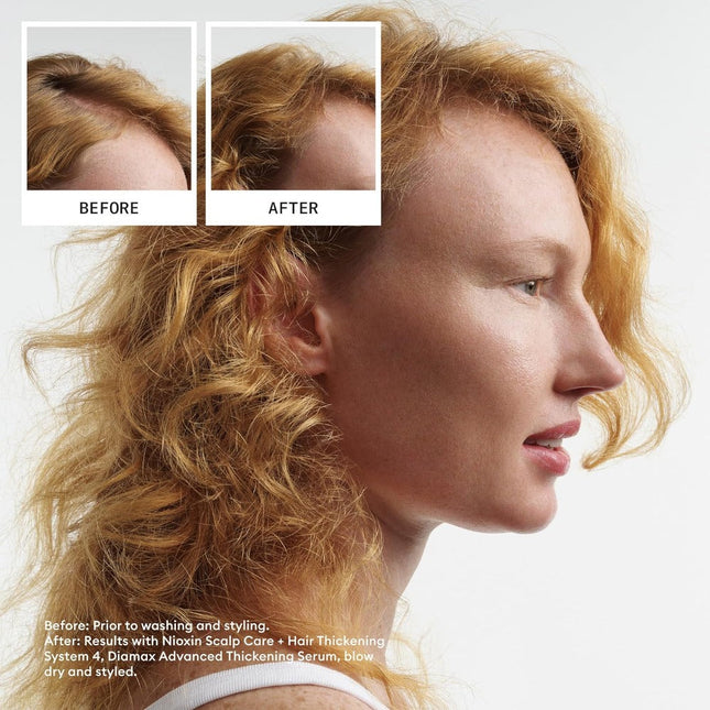 Nioxin System 4 Conditioner - Color Treated With Progressed Thinning