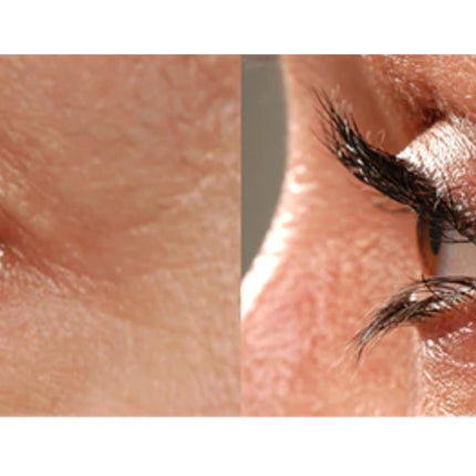 RapidLash Eyelash Enhancing Serum