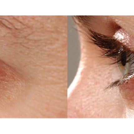 RapidLash Eyelash Enhancing Serum