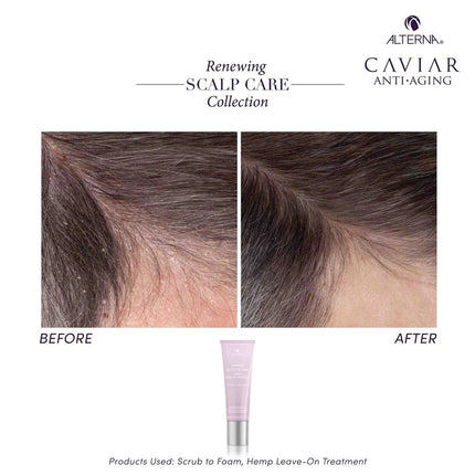 alterna-alterna-renewing-scalp-care-hemp-leave-on-treatment-7