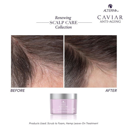 alterna-alterna-renewing-scalp-care-scrub-to-foam-8