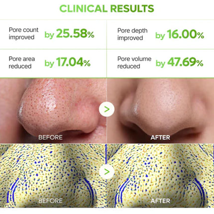 Dr. Melaxin CACTOX 3-Step Nose Mask Pack