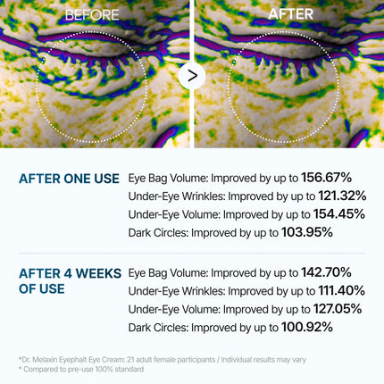 Dr. Melaxin Eyephalt Eyebag Cream