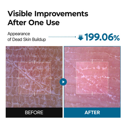 Dr. Melaxin Peel Shot Exfoliating TX Spray