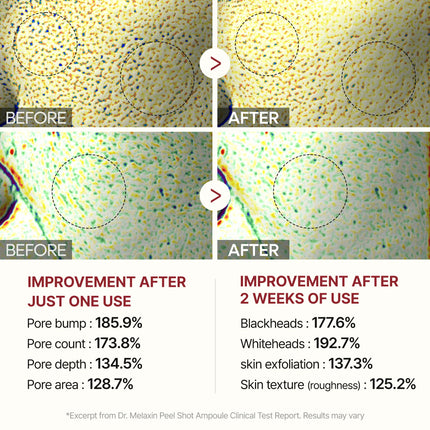 Dr. Melaxin Peel Shot Glow White Rice Ampoule