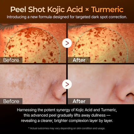 Dr. Melaxin Peel Shot Exfoliating Kojic Acid Turmeric Serum