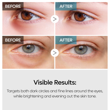 Dr. Melaxin TX Retinalsome Double Effect Eyecream