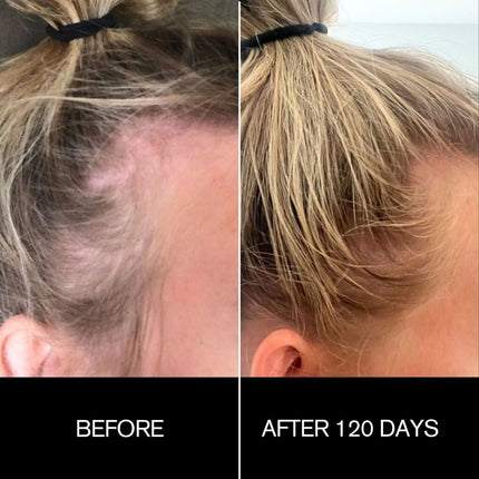 najeau-follicle-drops-5.jpg