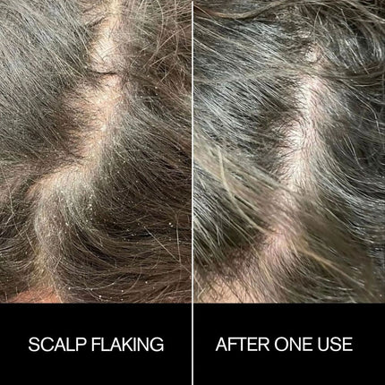 najeau-scalp-mask-4.jpg