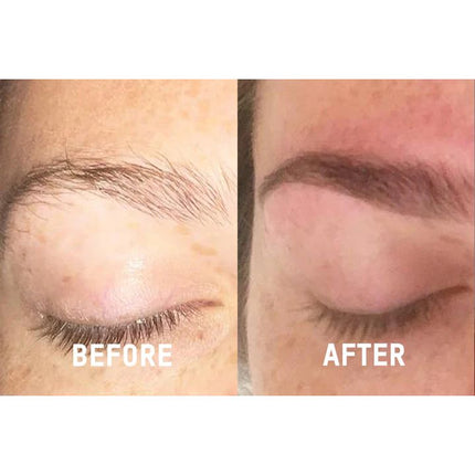 NourishLash Eyelash & Eyebrow Growth Serum Set