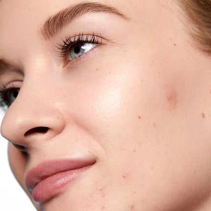 Peace Out Acne Day Dots - Jumbo