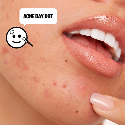 Peace Out Acne Day & Night Duo