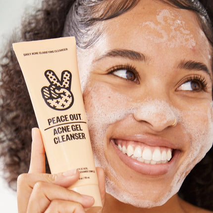 Peace Out Acne Gel Cleanser