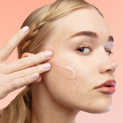 Peace Out Acne Gel Moisturizer