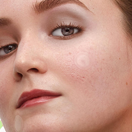 Peace Out Dark Spots Microneedling Dots