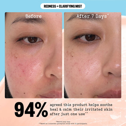 Peace Out Redness + Clarifying Mist