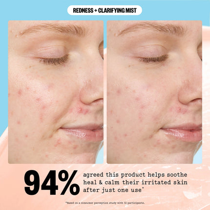 Peace Out Redness + Clarifying Mist