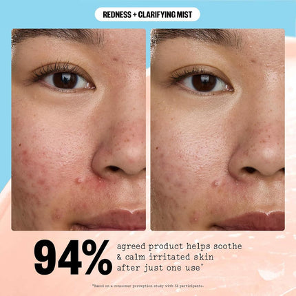 Peace Out Redness + Clarifying Mist