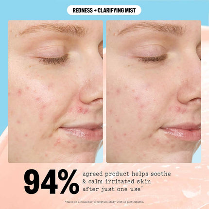 Peace Out Redness + Clarifying Mist